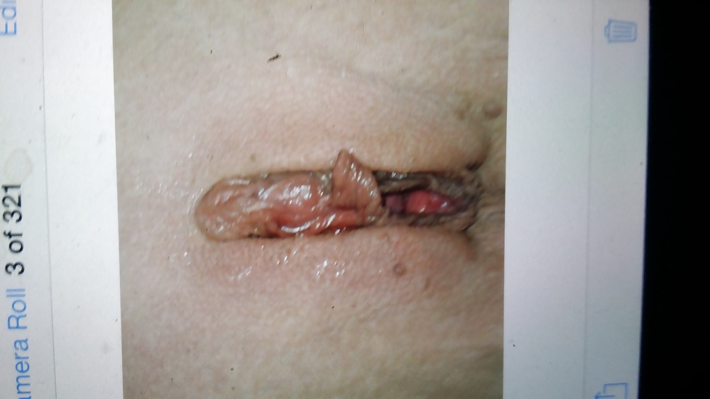 More stolen #34589587