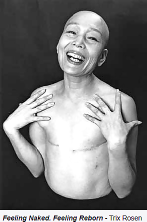 Cáncer desnudo - ciplak kanser
 #32629770