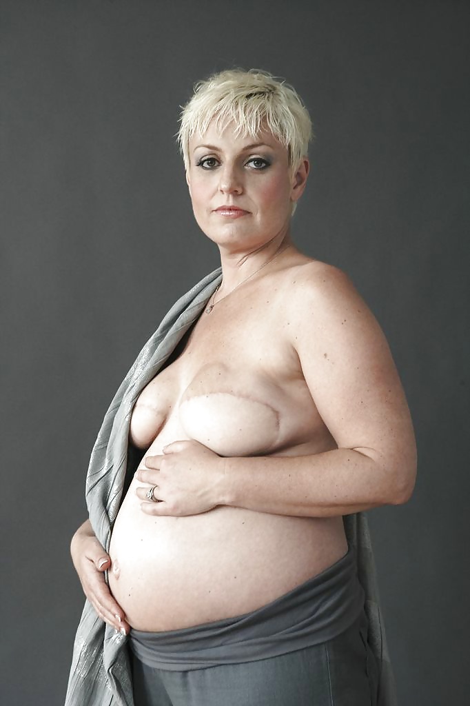 Cáncer desnudo - ciplak kanser
 #32629783