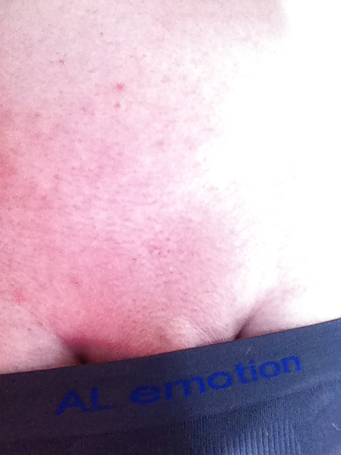 Mein teil
 #39421280