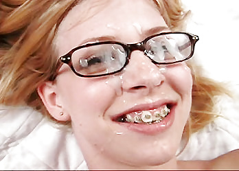 There is something on your braces #25362656