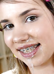There is something on your braces #25362667