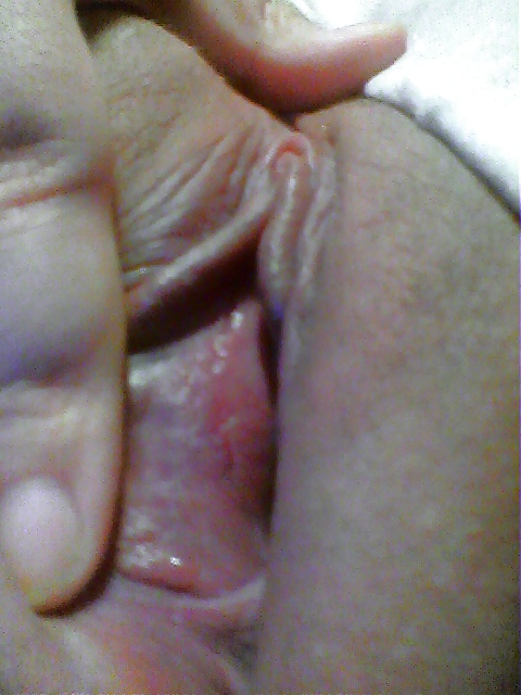 Exgf M Set 2 #37472206