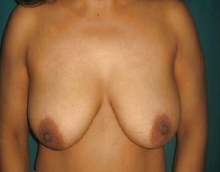 Big black areolas part 32 #30826986