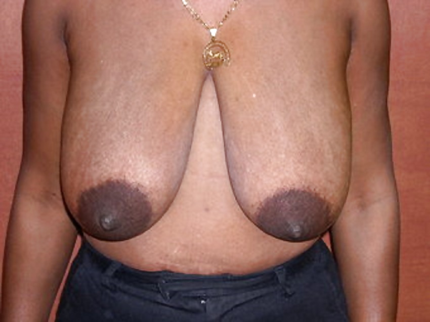 Areolas negras grandes parte 32
 #30827268