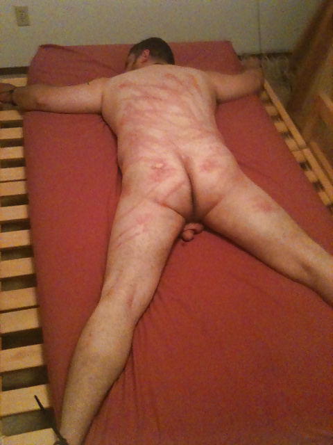 Flogging, Caning Marks from Mistress.  Bondage #28072693