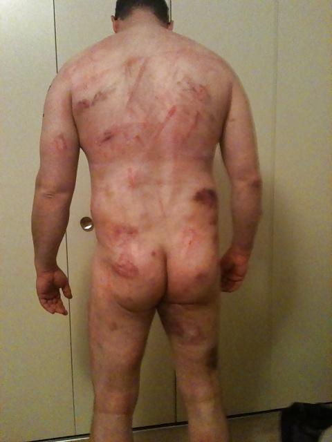 Flogging, Caning Marks from Mistress.  Bondage #28072700