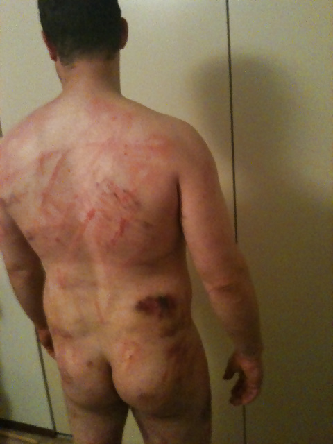 Flogging, Caning Marks from Mistress.  Bondage #28072706