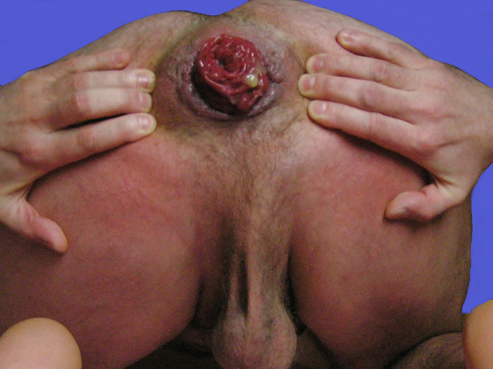 So Hot part 2. #33875599