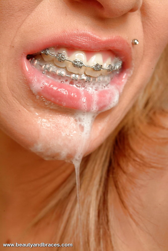 Cum on braces (Camaster) #36522366