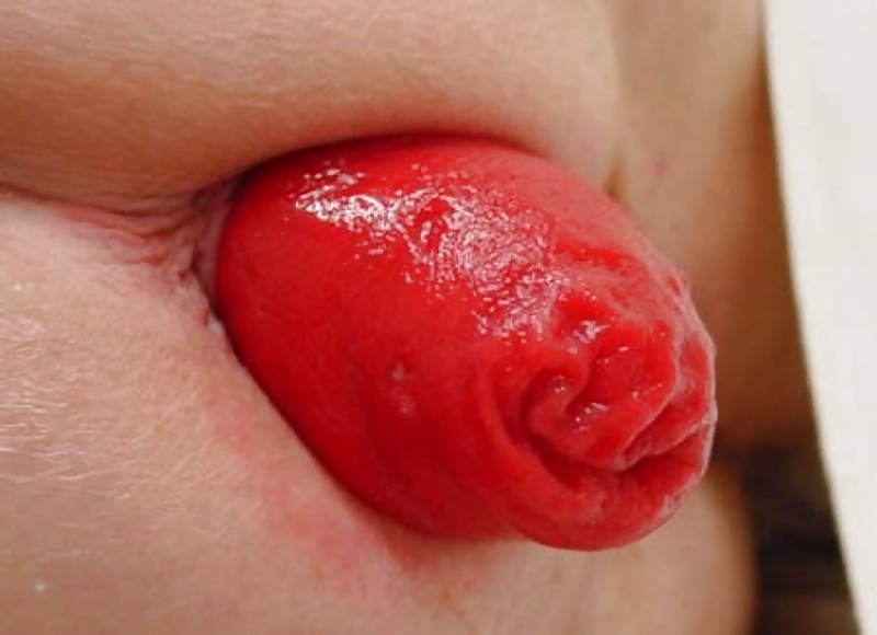 Prolasped Gaping and Spread Assholes-Open All Night #36 #39612282