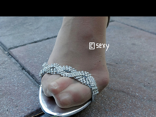 Bunion