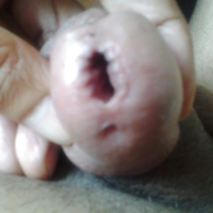 Sonando con pico de diente y bastoncillos para los oídos 
 #23417020