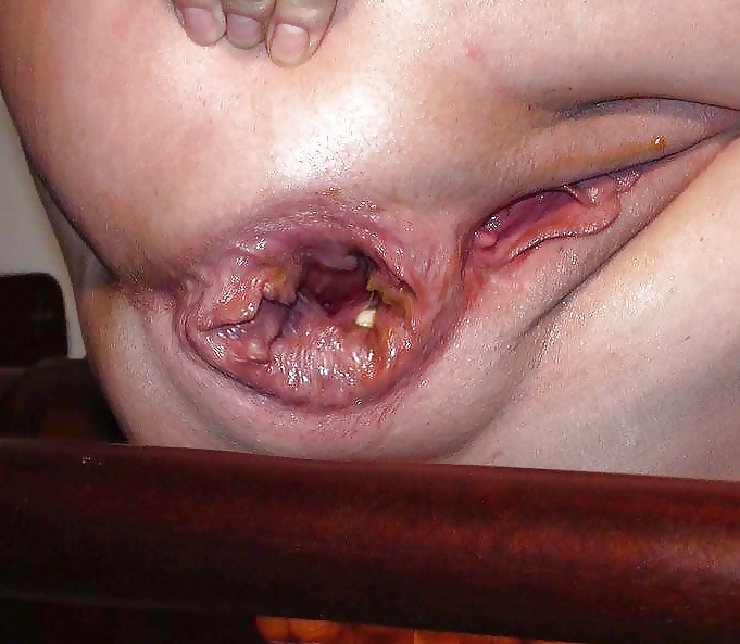 Gaping, ruined and prolapsed holes #30451358