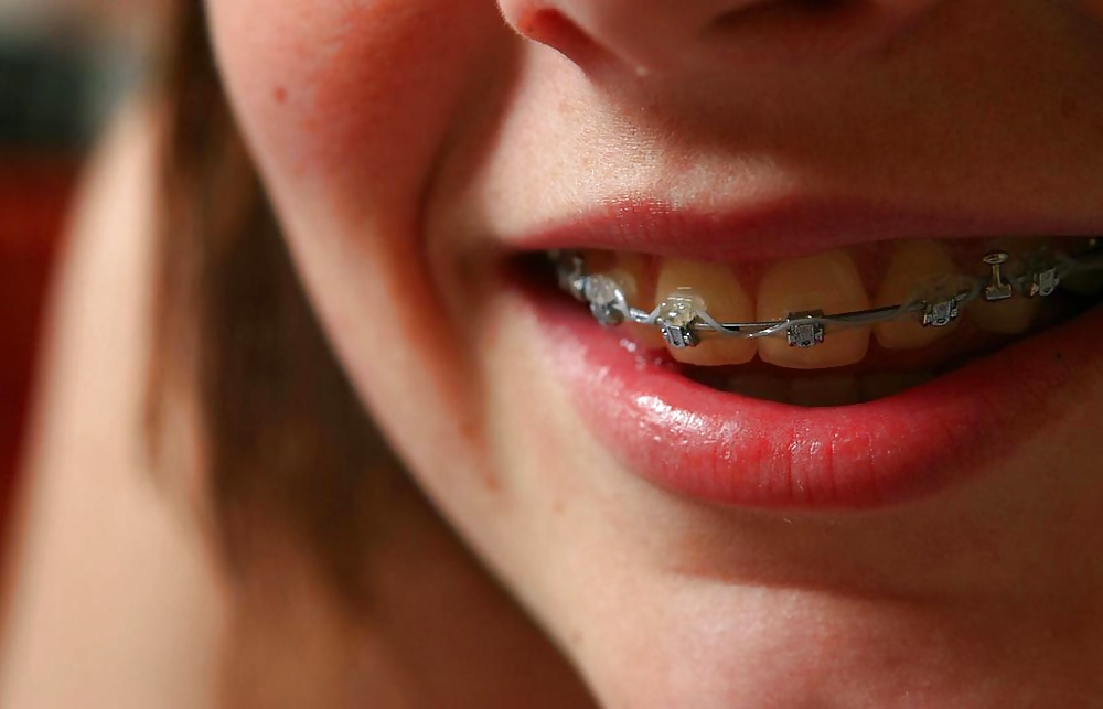 Teenie 492 #24273721