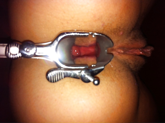 TOPBICHE anal speculum opened ass #36488020