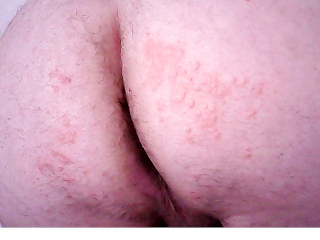 Cbt #34175296