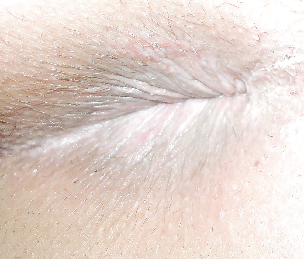 My teen butthole last night #25950828