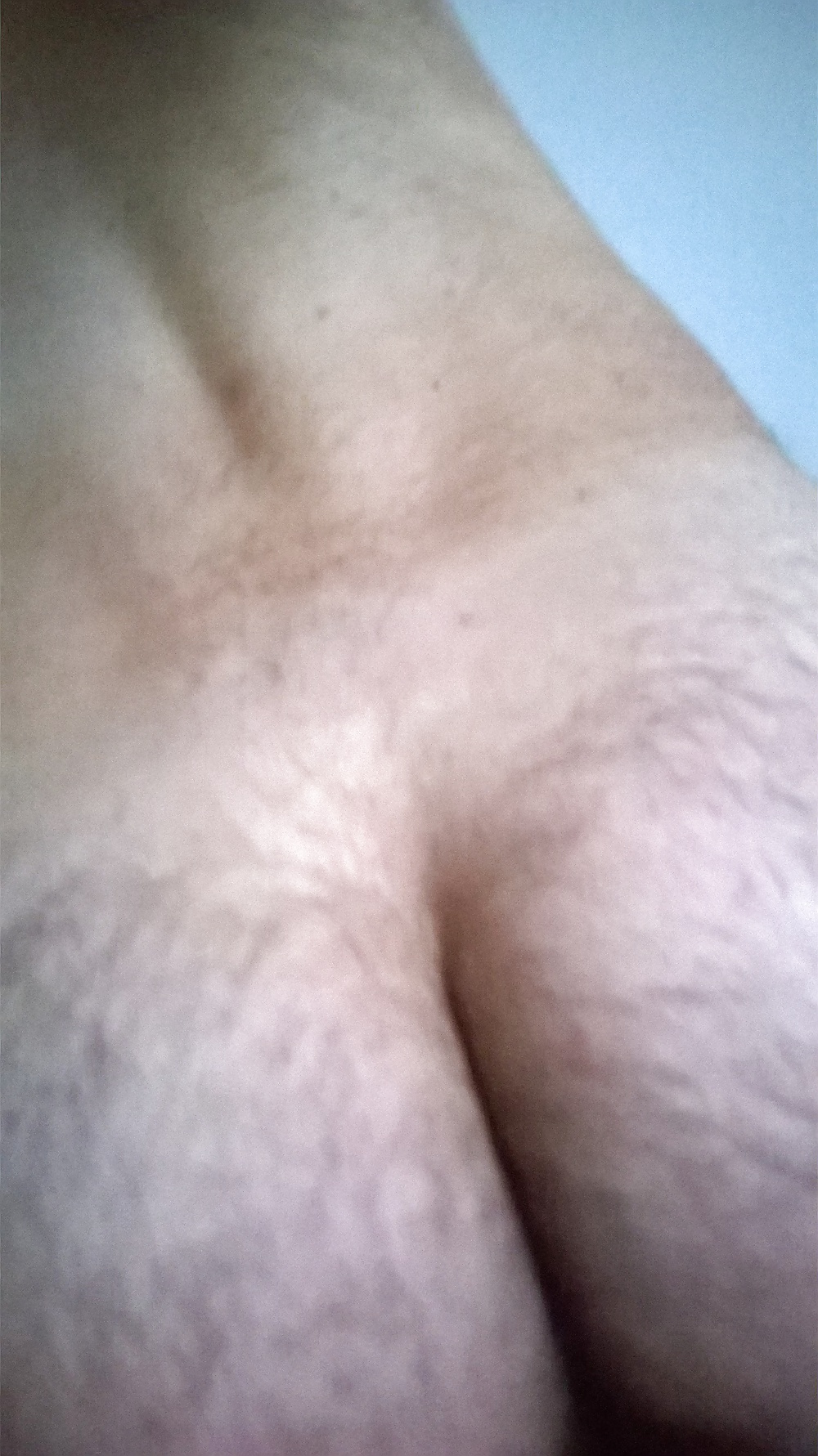 Mis otros
 #32563627