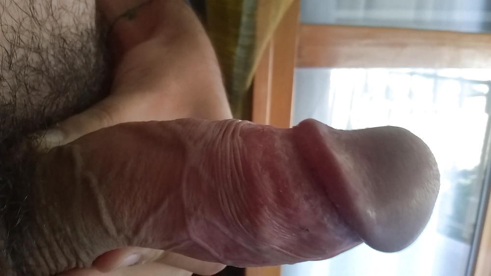 Mis otros
 #32563633