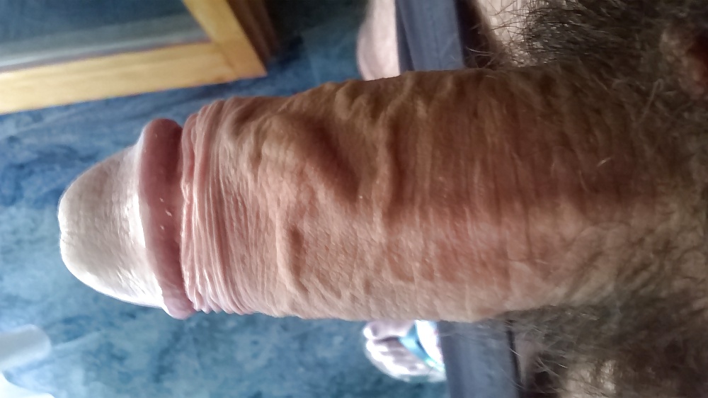 Mis otros
 #32563637