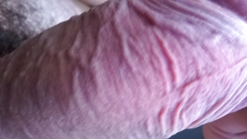 Mis otros
 #32563640