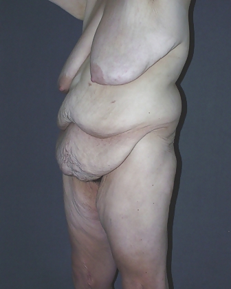 Why change the body part 4 #23536064