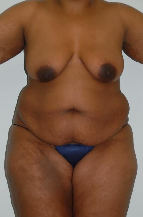 Why change the body part 4 #23536087
