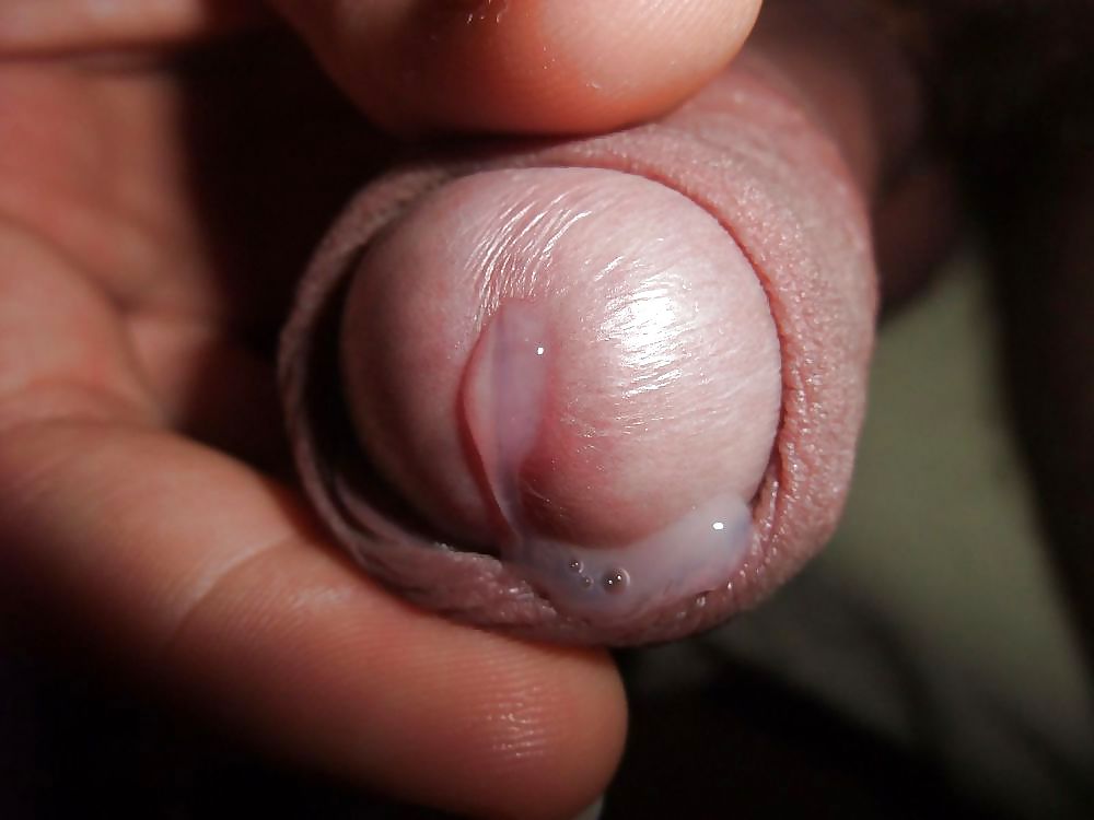 Hubby Behandlung #37258632