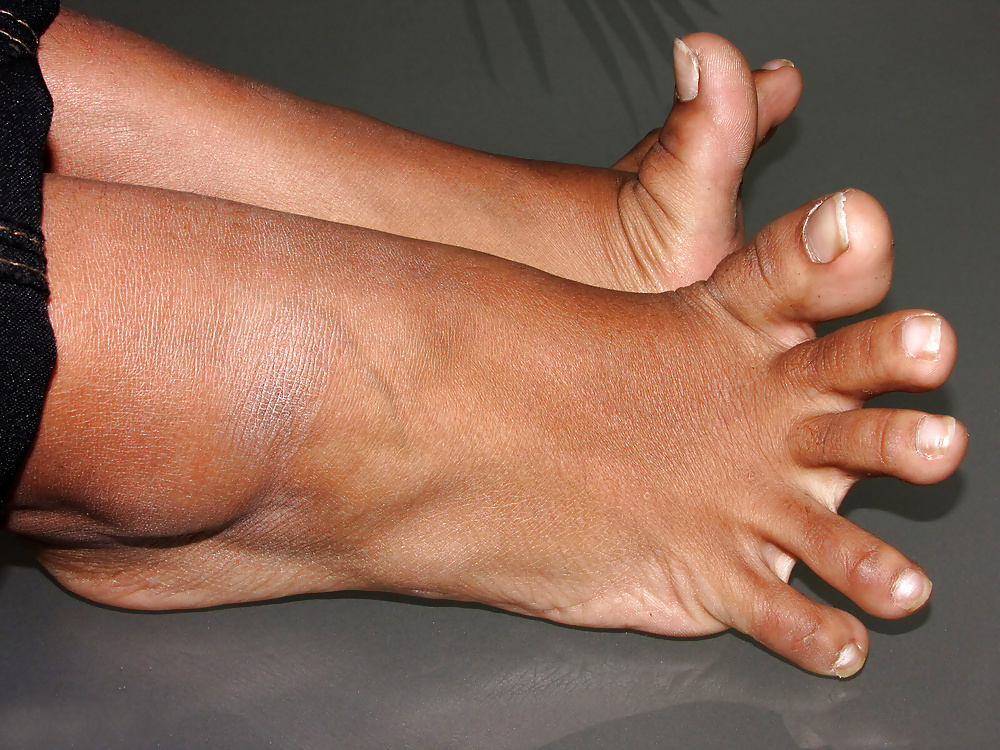 Stinkefüße #33469560