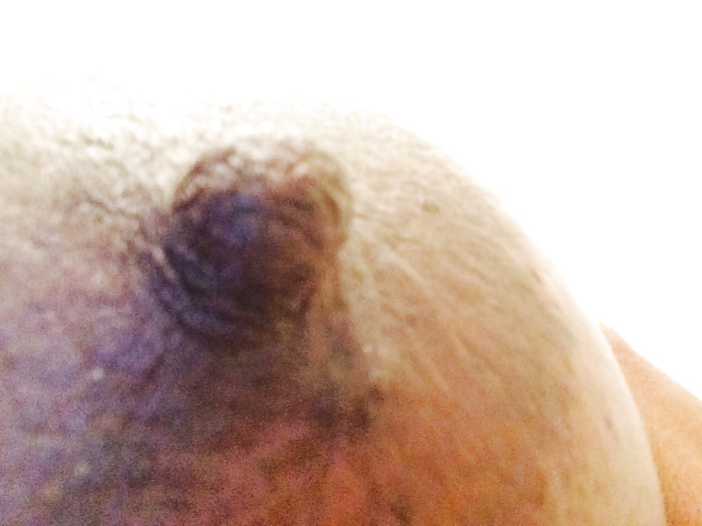 Nip1 #27452127