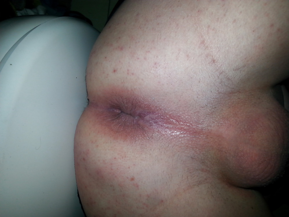 1. versuch #36826609