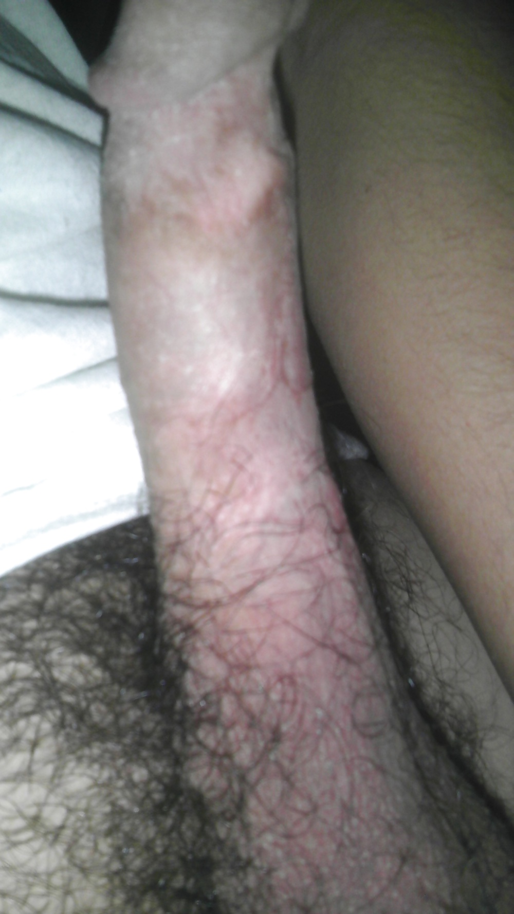 Yo(me) #34154901