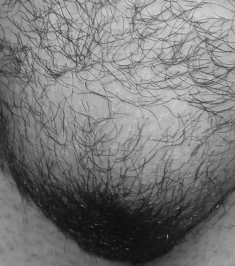 Up close  #28423728
