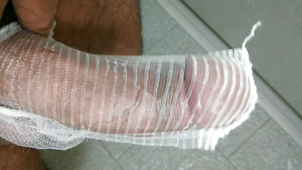 I capture with a net #31637281
