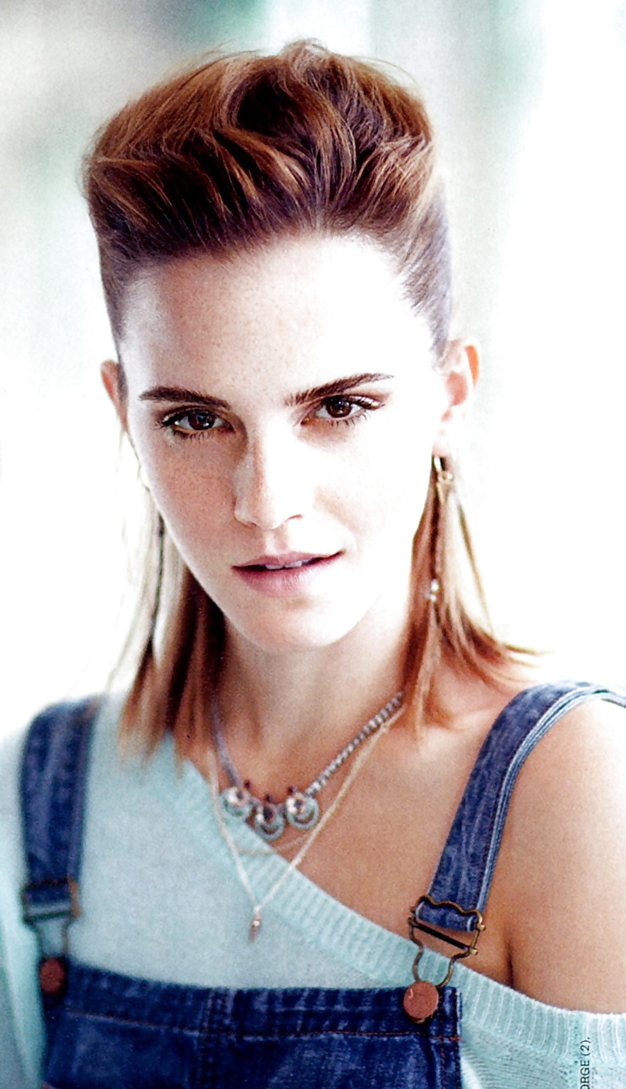 Emma Watson Freckles - Teen Vogue August 2013 #29434609
