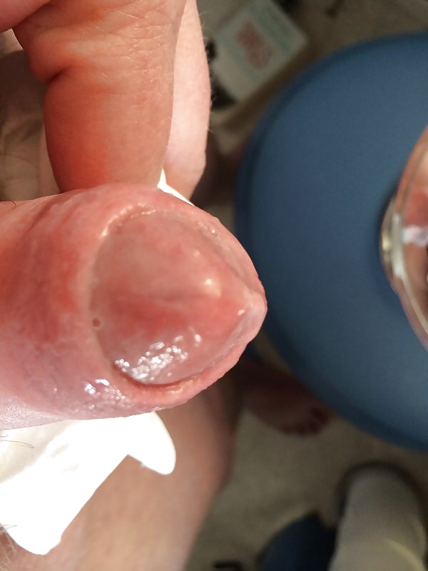 Lots of oline fun #28858061