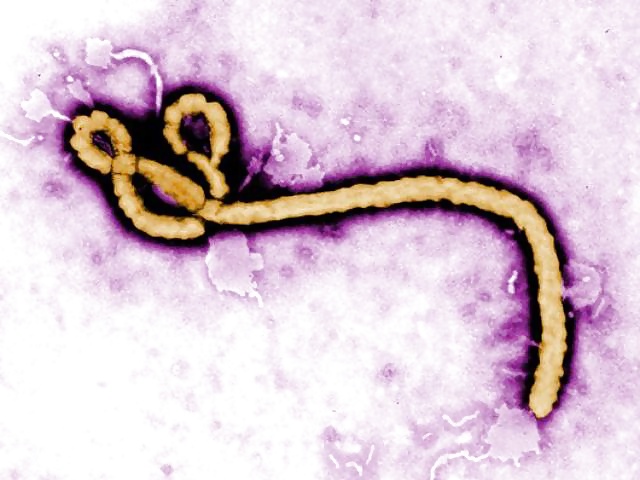 Xenex little moe: ebola and other pathogens in minutes.
 #29769109