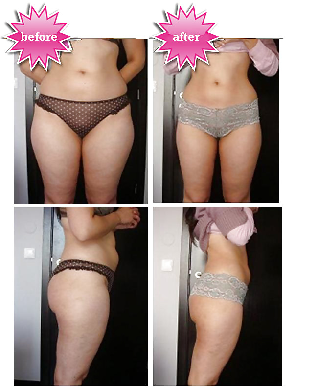 Pay to get it or get rid of it before and after #36882254