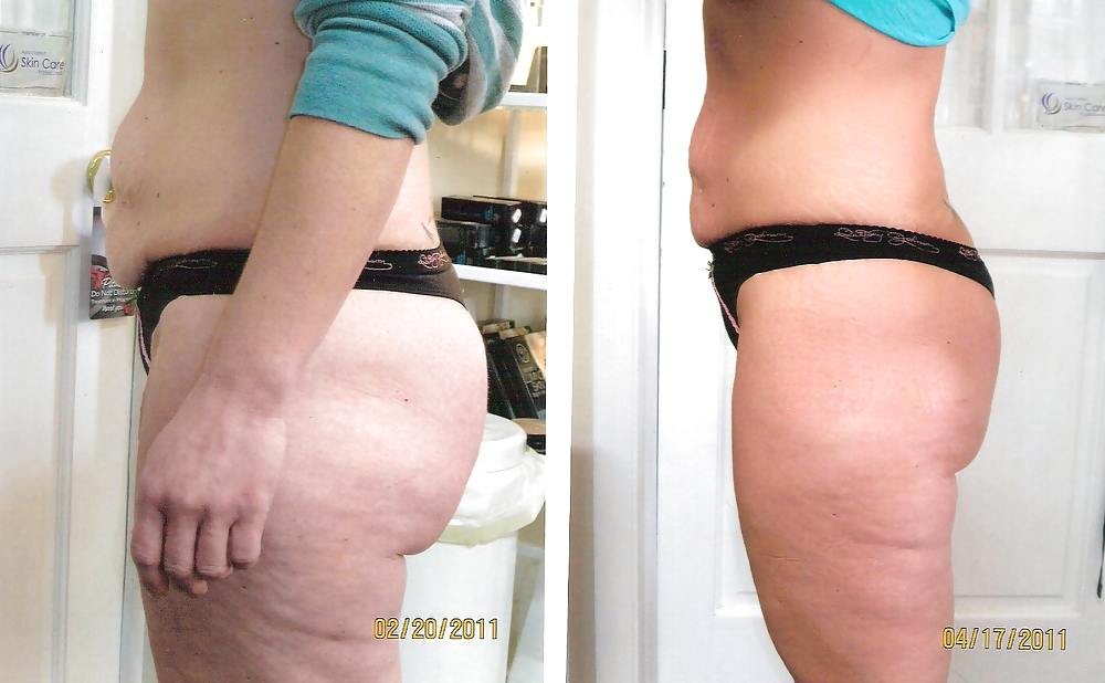 Pay to get it or get rid of it before and after #36882264