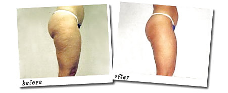 Pay to get it or get rid of it before and after #36882272