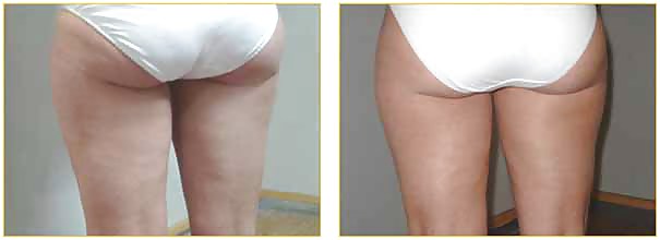 Pay to get it or get rid of it before and after #36882328
