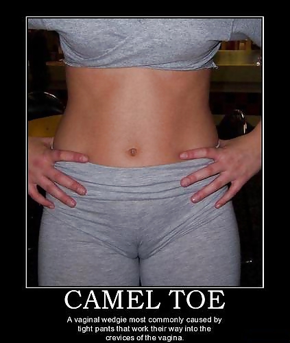 From the Moshe Files: Camel Toe Humour #25331135