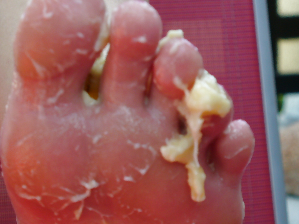 Barefeet and banana #38146250