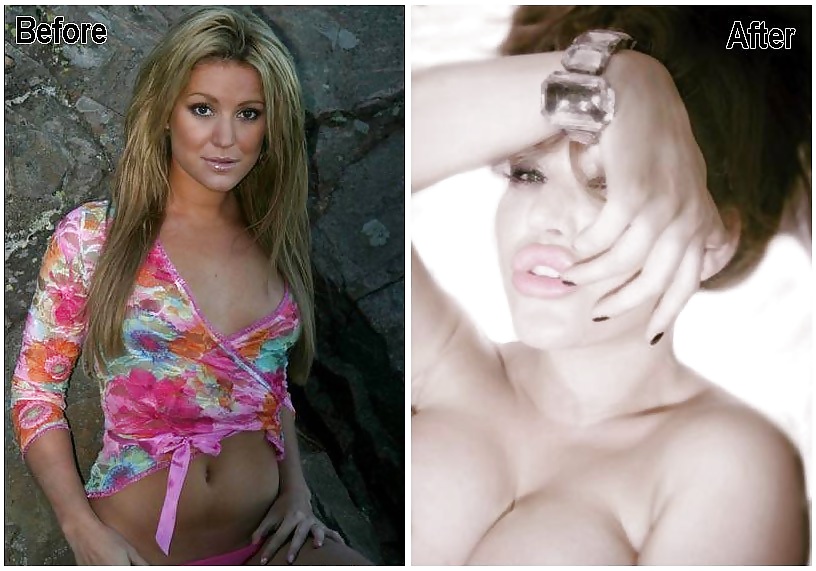 Before and After - Bimbo Edition #34874907