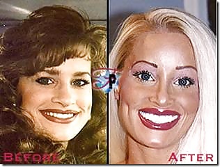 Antes y después - edición bimbo
 #34874986