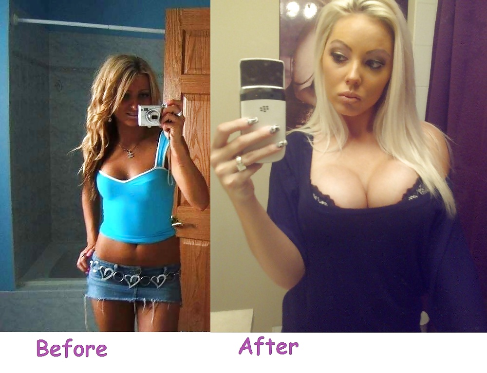 Before and After - Bimbo Edition #34875068