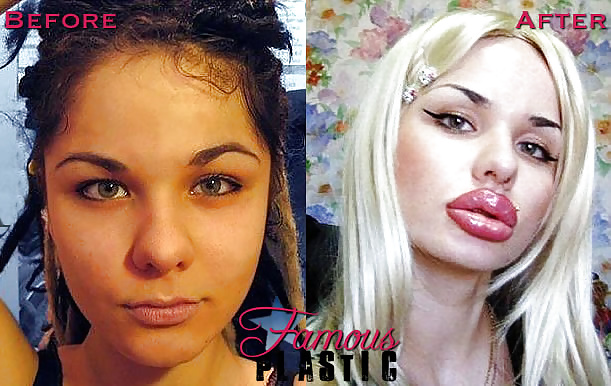 Before and After - Bimbo Edition #34875123