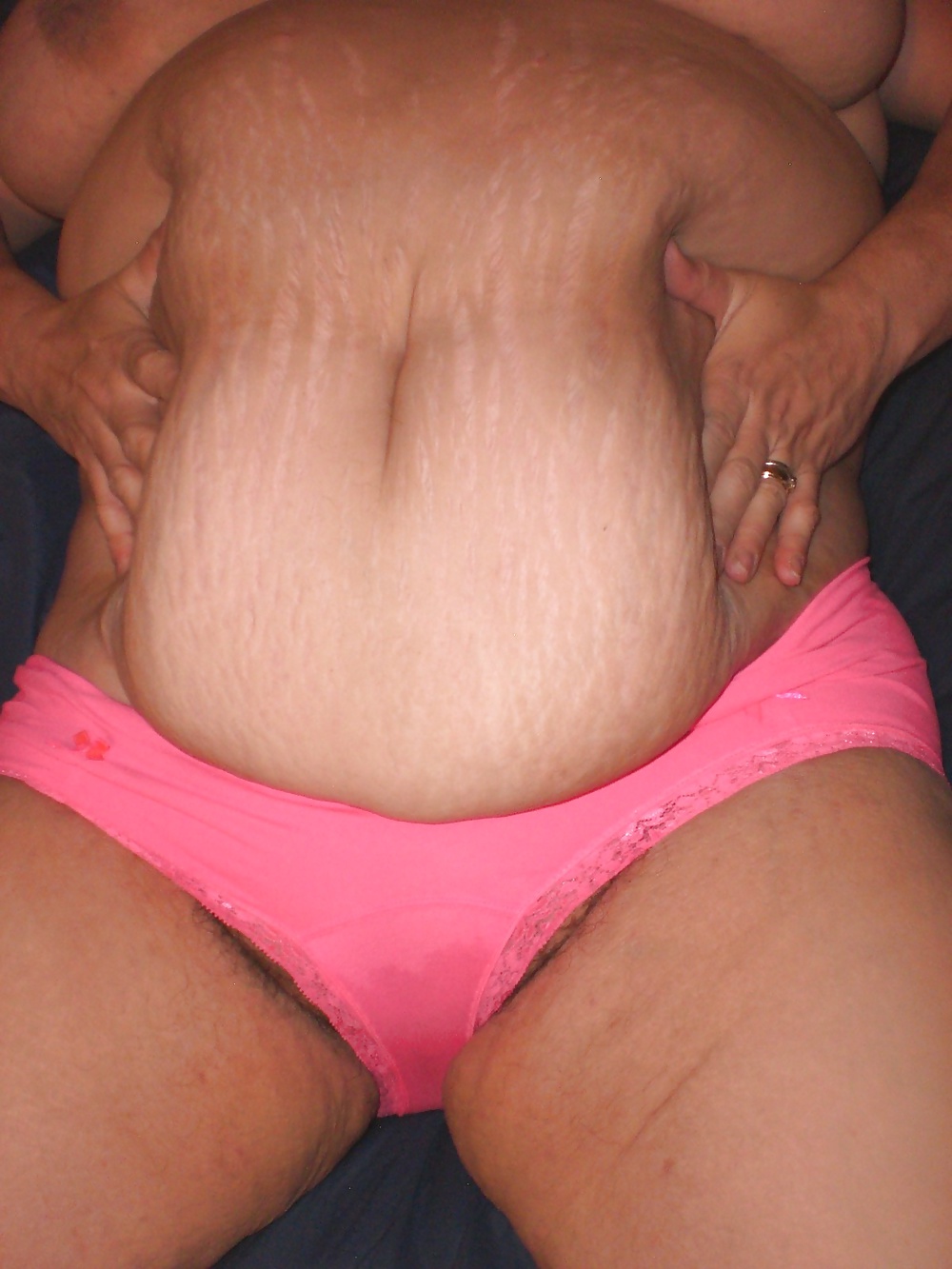 2014 new Saggy tits Flabby thigs Strech marked BBW slob wife #27840181