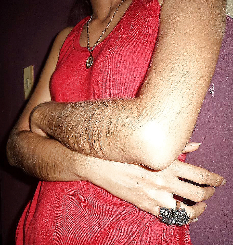 Girl with very hairy arms #23253065